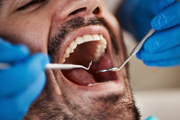 Best Dental Abscess Treatment in Fallon, NV
