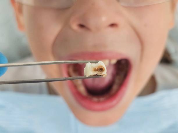 Best Emergency Treatment for Oral Infections in Fallon, NV